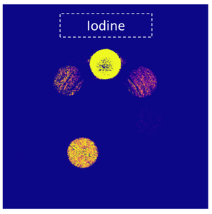 Material Decomposition